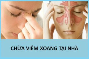 Chữa viêm xoang tại nhà